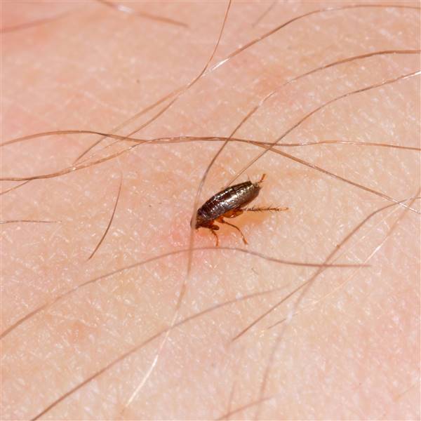 Picadura de pulga: cómo es, qué provoca y cómo eliminarlas