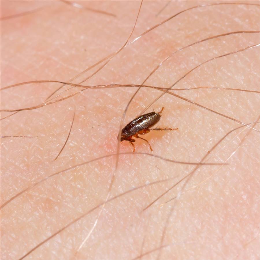 Picadura de pulga: cómo es, qué causa y cómo eliminarlas.